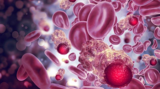 Καρκινικά κύτταρα αίματος