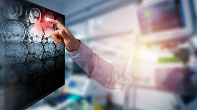 Απεικόνιση εγκεφαλικού επεισοδίου