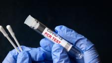 pcr test, koronoios, coronoios, corona virus